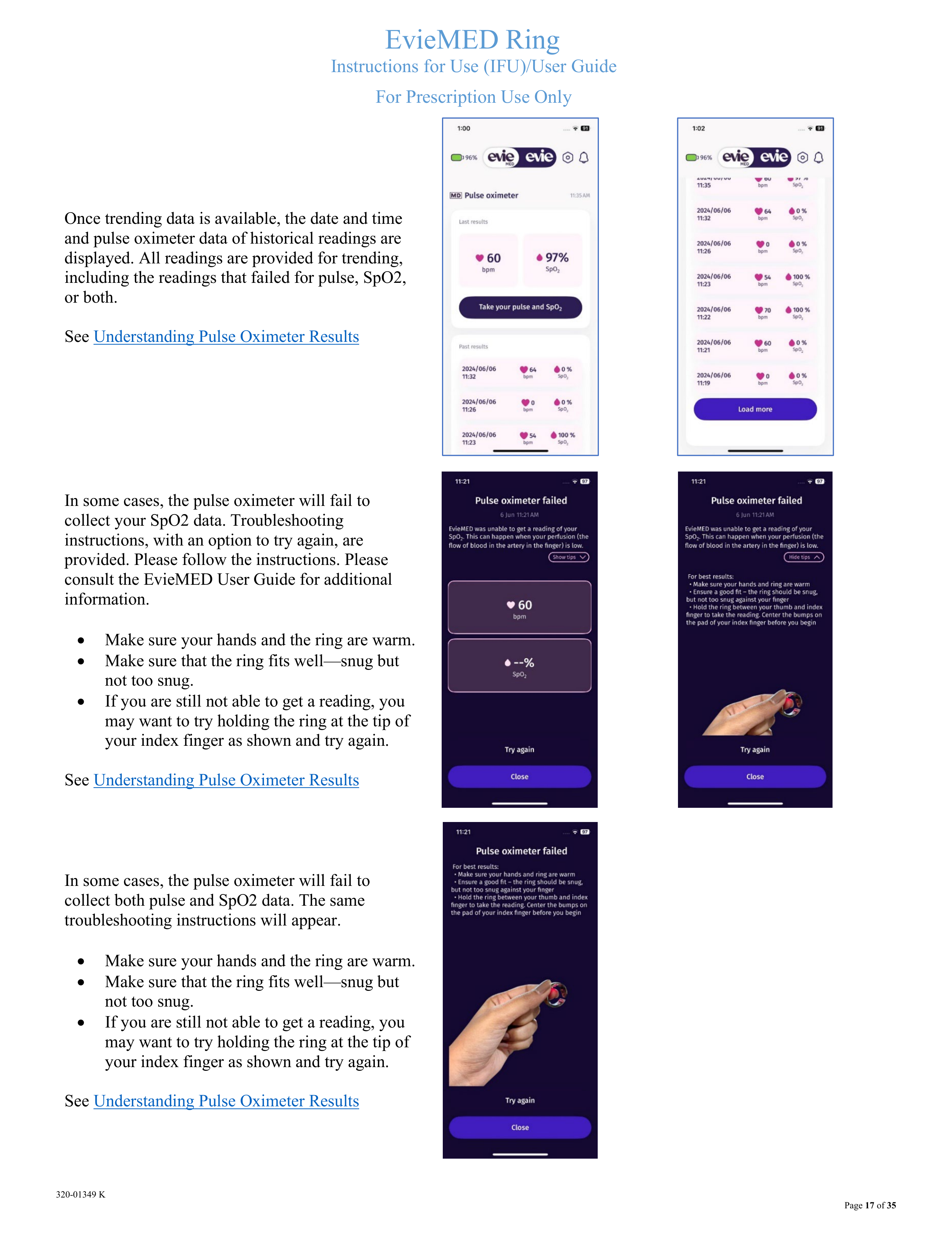 320-01349 K EvieMED User Guide_f-17.png