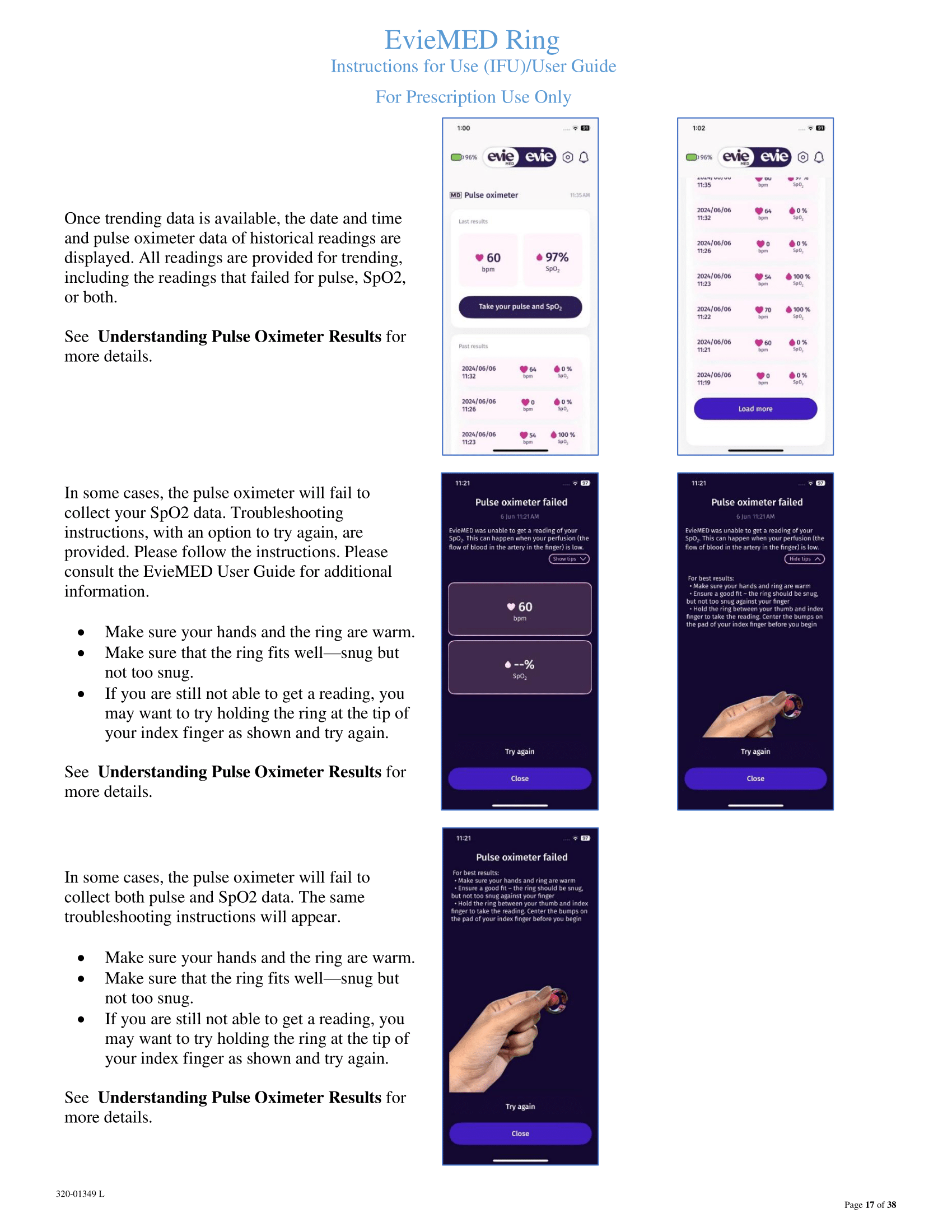 320-01349 L EvieMED User Guide-17.png